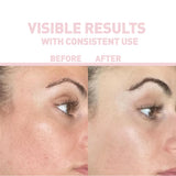 THE NORDEA AHA 10% + BHA 2% + LINGON EXFOLIANT