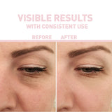 THE NORDEA HYALURONSYRA 2% + ARKTISKA ALGER + B5 SERUM