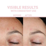 THE NORDEA RETINOL 1% SERUM